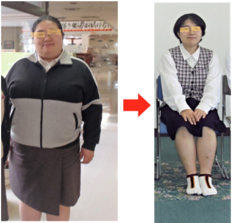 エステで婚活コース