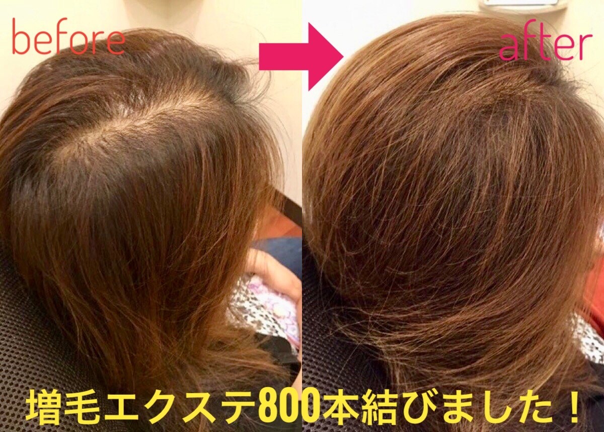増毛エクステ