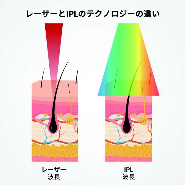 カレントボディスキン　レーザーヘアリムーバル