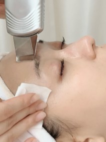 スクライバー施術